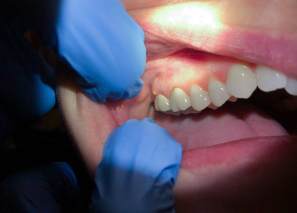 Best Tooth Infection Emergency Dentist  in Greenwood Lake, NY